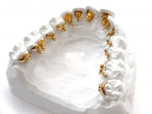 ABC's of Orthodontics