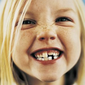 Orthodontic Treatment Before Braces